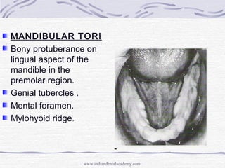 MANDIBULAR TORI
Bony protuberance on
lingual aspect of the
mandible in the
premolar region.
Genial tubercles .
Mental fora...