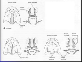 dị tật bẩm sinh hàm mặt.pdf