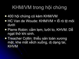 dị tật bẩm sinh hàm mặt.pdf