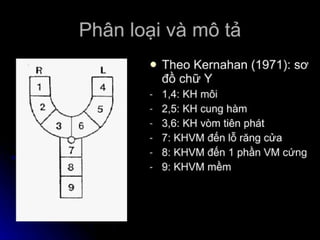 dị tật bẩm sinh hàm mặt.pdf