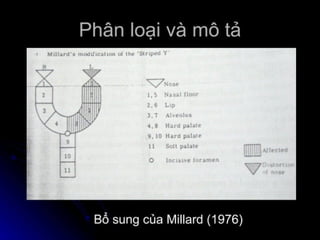dị tật bẩm sinh hàm mặt.pdf