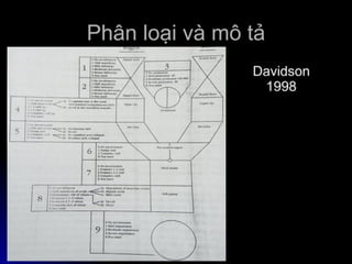 dị tật bẩm sinh hàm mặt.pdf