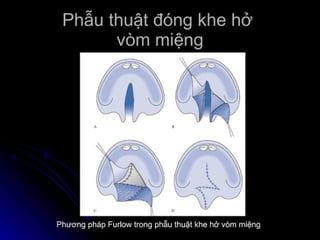 dị tật bẩm sinh hàm mặt.pdf