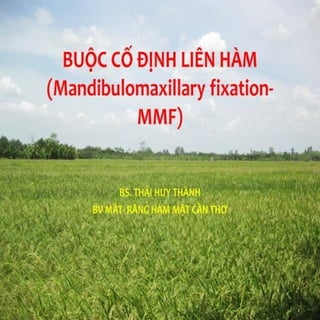 dị tật bẩm sinh hàm mặt.pdf