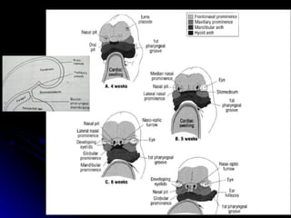 dị tật bẩm sinh hàm mặt.pdf