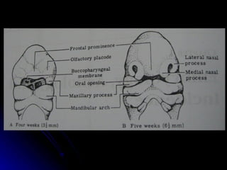 dị tật bẩm sinh hàm mặt.pdf