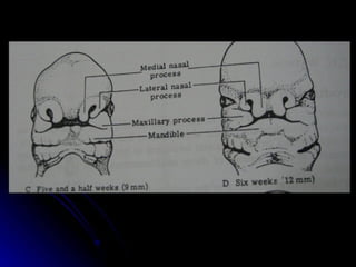 dị tật bẩm sinh hàm mặt.pdf