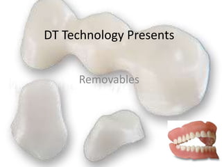 DT Technology Presents 
Removables 
 