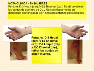 NOTA CLINICA - EN MUJERES
Punture ID-3 Houxi (der), V-62 Shenmai (izq). Es util combinar
los puntos de apertura de Du y Ren; particularmente en
deficiencia pronunciadas de Riñón con síntomas ginecológicos.
Punture: ID-3 Houxi
(der), V-62 Shenmai
(izq), P-7 Lieque (Izq)
y R-6 Zhaohai (der),
retirar las agujas en
orden inverso.
 