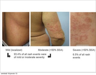 vendredi 18 janvier 13
 