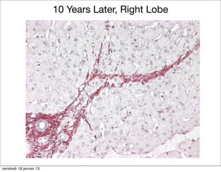 10 Years Later, Right Lobe




vendredi 18 janvier 13
 