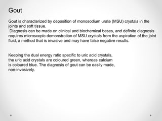Gout
Gout is characterized by deposition of monosodium urate (MSU) crystals in the
joints and soft tissue.
Diagnosis can be made on clinical and biochemical bases, and definite diagnosis
requires microscopic demonstration of MSU crystals from the aspiration of the joint
fluid, a method that is invasive and may have false negative results.
Keeping the dual energy ratio specific to uric acid crystals,
the uric acid crystals are coloured green, whereas calcium
is coloured blue. The diagnosis of gout can be easily made,
non-invasively.
 