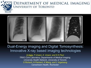 Dual-Energy imaging and Digital Tomosynthesis:
Innovative X-ray based imaging technologies
S Sajja, F Ursani, A Ursani, and N S Paul
TRIIO Core Laboratory, Departments of Medical Imaging,
University Health Network, University of Toronto
S Richard, N Packard, X Wang, and L Vogelsang
Carestream Health, Rochester
 
