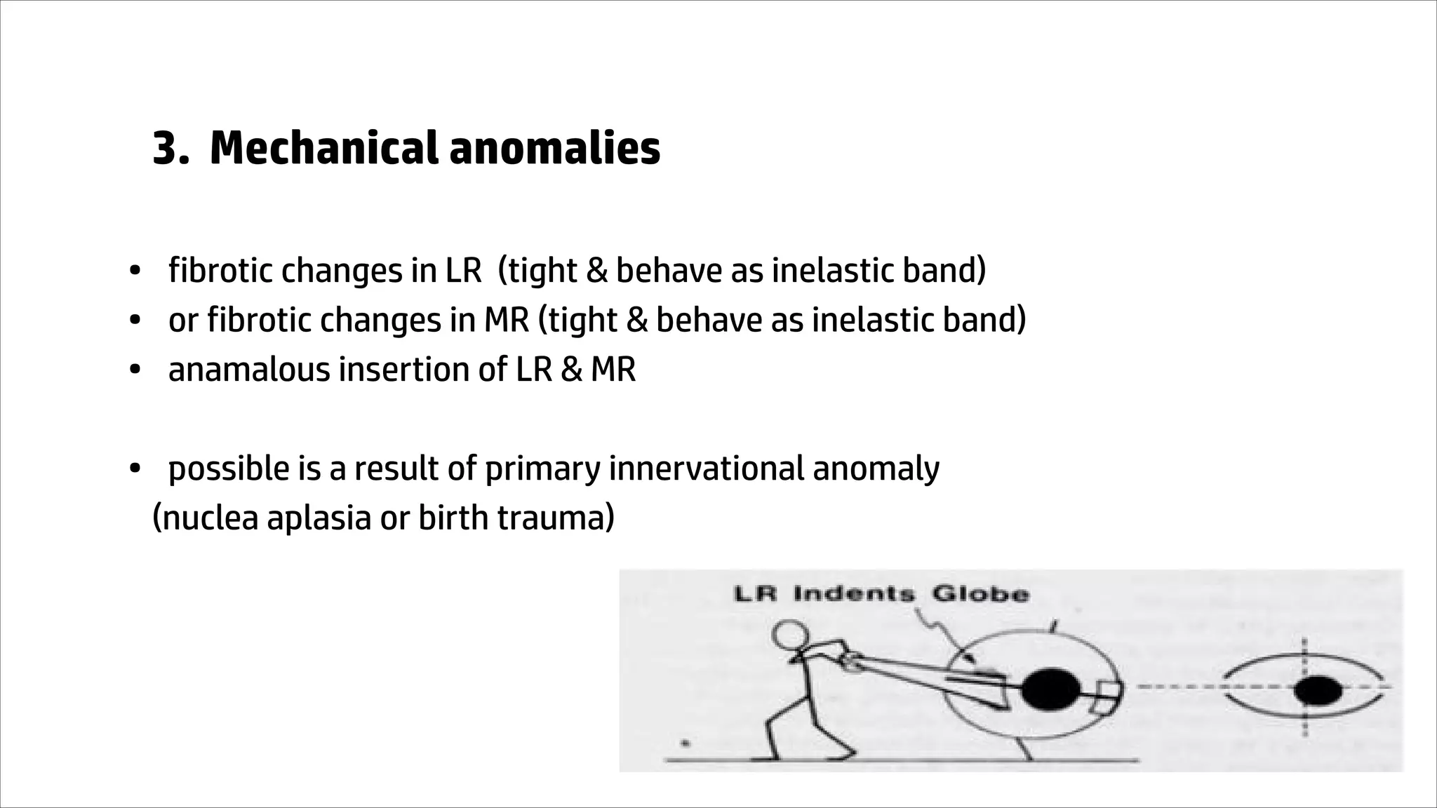 3. Mechanical anomalies
• fibrotic changes in LR (tight & behave as inelastic band)
• or fibrotic changes in MR (tight & behave as inelastic band)
• anamalous insertion of LR & MR
• possible is a result of primary innervational anomaly
(nuclea aplasia or birth trauma)
 