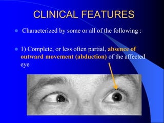 CLINICAL FEATURES
 Characterized by some or all of the following :
 1) Complete, or less often partial, absence of
outward movement (abduction) of the affected
eye
 