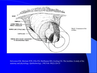 Helveston EM, Merriam WW, Ellis FD, Shellhamer RH, Gosling CG. The trochlea. A study of the
anatomy and physiology. Ophthalmology. 1982 Feb. 89(2):124-33
 