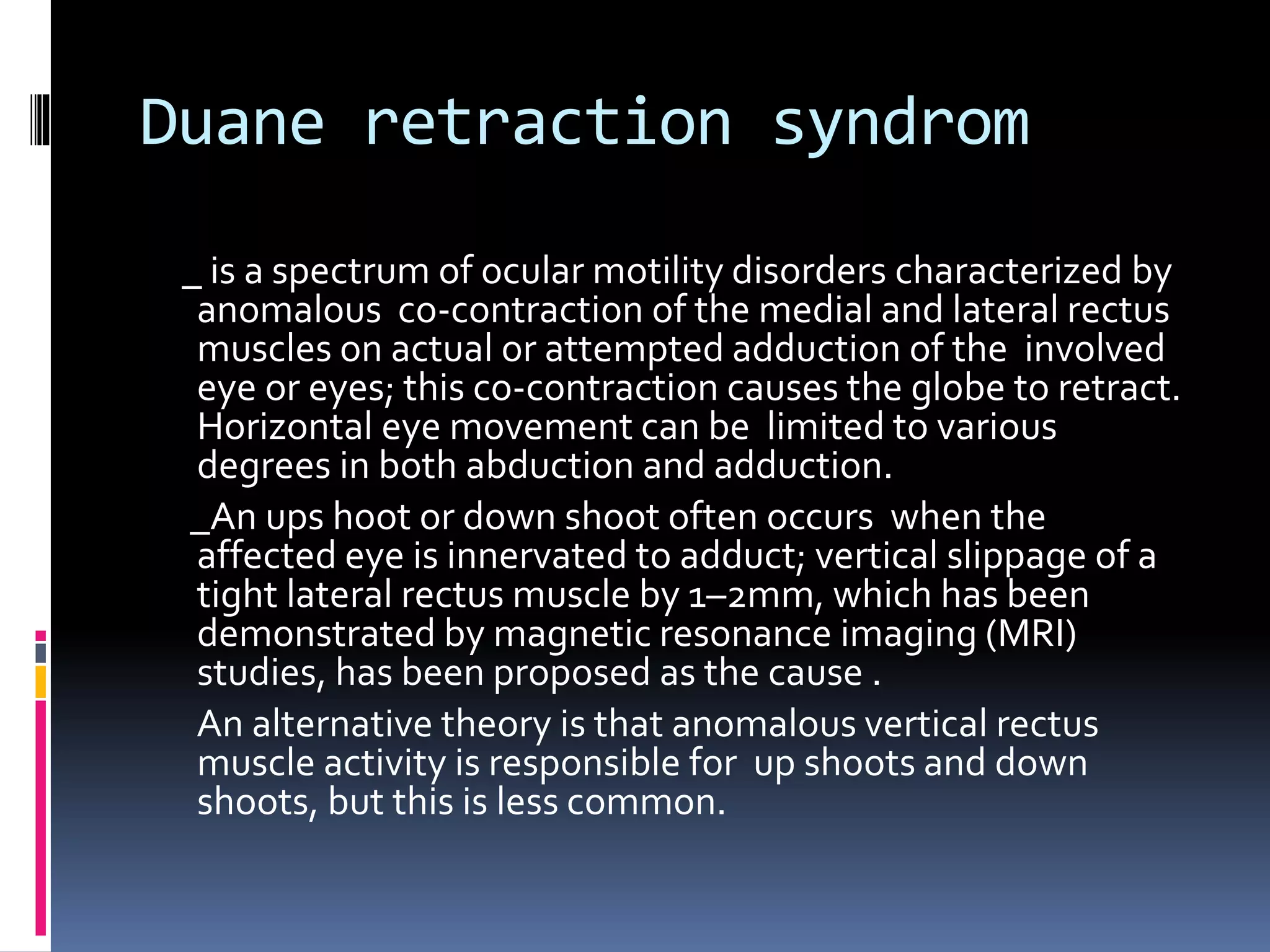 Duane syndrome 2 | PPT
