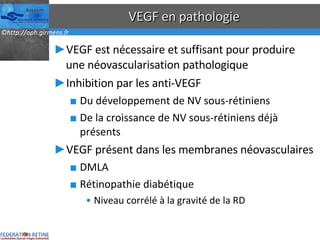 VEGF en pathologie VEGF est nécessaire et suffisant pour produire une néovascularisation pathologique Inhibition par les anti-VEGF Du développement de NV sous-rétiniens De la croissance de NV sous-rétiniens déjà présents VEGF présent dans les membranes néovasculaires DMLA Rétinopathie diabétique Niveau corrélé à la gravité de la RD 