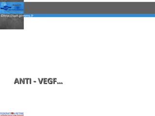 ANTI - VEGF… 