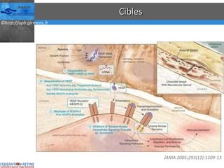 Cibles JAMA 2005;293(12):1509-13 