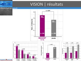 VISION | résultats 