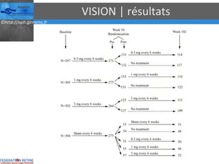 VISION | résultats 