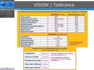 VISION | Tolérance 