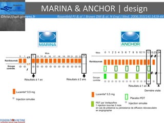 MARINA & ANCHOR | design Résultats à 2 ans Mois Ranibizumab  Groupe contr ôle 0 1 12 24 Résultats à 1 an 13 14 15 16 17 18 19 20 21 22 23 Résultats à 1 an 0 1 2 3 4 5 6 7 8 9 10 11 12 24 Groupe  contr ôle   Mois Ranibizumab Lucentis ®  0,5 mg  Placebo PDT PDT par Vertéporfine 1 injection tous les 3 mois  en cas de présence ou persistance de diffusion néovasculaire  en angiographie 13 - 23 Dernière visite Lucentis ®  0,5 mg Rosenfeld PJ & al | Brown DM & al. N Engl J Med. 2006;355(14):1419-44 Injection simulée Injection simulée 