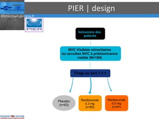 PIER | design Ranibizumab 0,3 mg (n=60) Ranibizumab 0,5 mg (n=61) Tirage au sort 1:1:1 Inclusions des  patients NVC Visibles minoritaires  ou occultes NVC à prédominance  visible (N=184)  Placebo (n=63) 