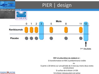 PIER | design Mois Ranibizumab  Placebo  0 1 2 3 5 8 11 12 1 ers  résultats PDT à la discrétion du médecin si :  Si transformation en NVC à prédominance visible ou Si perte ≥ 20 lettres sur une période de 3 mois (au moins deux visites consécutives) Si surface de la lésion ≤ 4 DA Si la lésion néovasculaire est active 