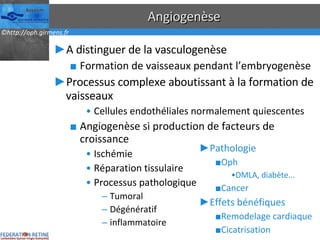 Angiogenèse A distinguer de la vasculogenèse Formation de vaisseaux pendant l’embryogenèse Processus complexe aboutissant à la formation de vaisseaux Cellules endothéliales normalement quiescentes Angiogenèse si production de facteurs de croissance Ischémie Réparation tissulaire Processus pathologique Tumoral Dégénératif inflammatoire Pathologie Oph DMLA, diabète... Cancer Effets bénéfiques Remodelage cardiaque Cicatrisation 