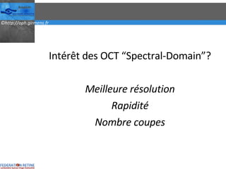 Intérêt des OCT “Spectral-Domain”? Meilleure résolution Rapidité Nombre coupes 