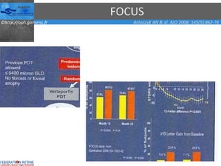 FOCUS Antoszyk AN & al. AJO 2008; 145(5):862-74 
