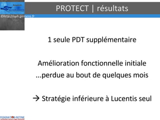 PROTECT | résultats 1 seule PDT supplémentaire Amélioration fonctionnelle initiale ...perdue au bout de quelques mois    Stratégie inférieure à Lucentis seul 