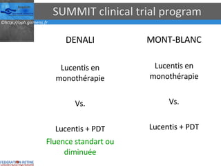 SUMMIT clinical trial program DENALI Lucentis en monothérapie Vs. Lucentis + PDT Fluence standart ou diminuée MONT-BLANC Lucentis en monothérapie Vs. Lucentis + PDT 