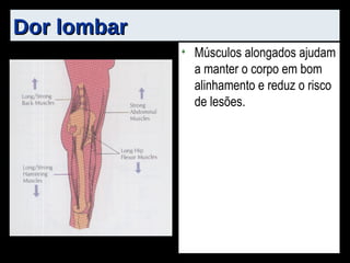 Dor lombar Músculos alongados ajudam a manter o corpo em bom alinhamento e reduz o risco de lesões. 