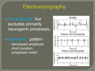  not

diagnostic but
excludes primarily
neurogenic processes.

 Myopathic

pattern

• decreased amplitude,

short duration,
polyphasic motor

 