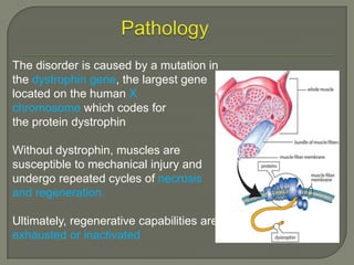 The disorder is caused by a mutation in
the dystrophin gene, the largest gene
located on the human X
chromosome which codes for
the protein dystrophin

Without dystrophin, muscles are
susceptible to mechanical injury and
undergo repeated cycles of necrosis
and regeneration.
Ultimately, regenerative capabilities are
exhausted or inactivated

 