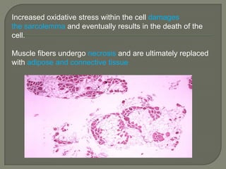 Increased oxidative stress within the cell damages
the sarcolemma and eventually results in the death of the
cell.
Muscle fibers undergo necrosis and are ultimately replaced
with adipose and connective tissue

 