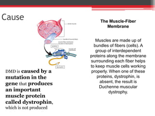 Duchenne Muscular Dystrophy | PDF