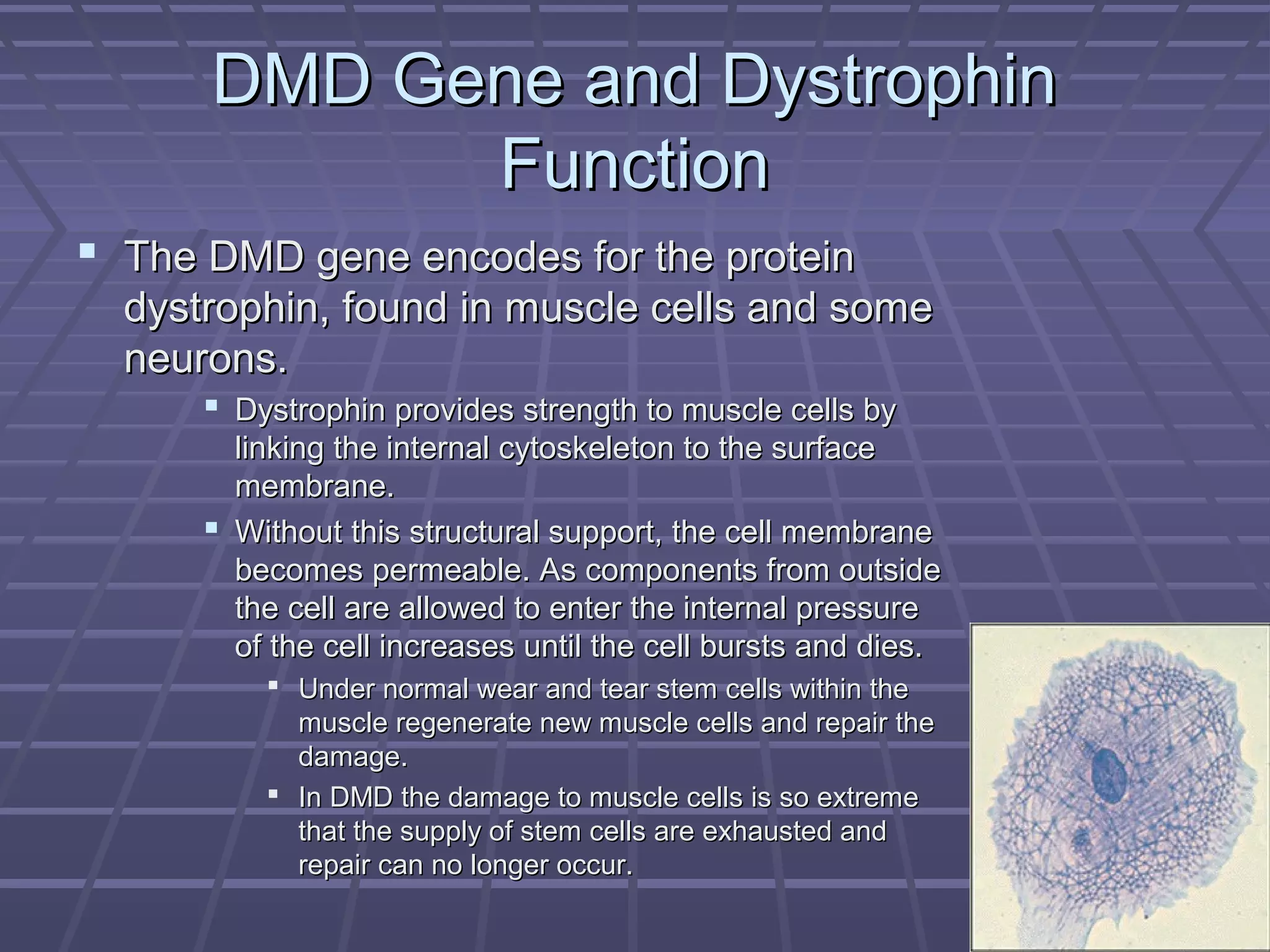Duchenne muscular dystrophy | PPT