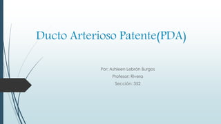 Ducto Arterioso Patente(PDA)
Por: Ashleen Lebrón Burgos
Profesor: Rivera
Sección: 352
 