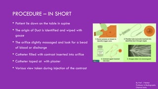PROCEDURE – IN SHORT
• Patient lie down on the table in supine
• The origin of Duct is identified and wiped with
gauze
• The orifice slightly massaged and look for a bead
of blood or discharge
• Catheter filled with contrast inserted into orifice
• Catheter taped at with plaster
• Various view taken during injection of the contrast
By Prof J Venkat
Professor in Radiography
Chennai India
 