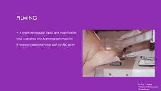 FILMING
• A single craniocaudal digital spot magnification
view is obtained with Mammography machine
If necessary additional views such as MLO taken
By Prof J Venkat
Professor in Radiography
Chennai India
 