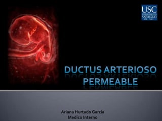 DUCTUS ARTERIOSO PERMEABLE Ariana Hurtado Garcia Medico Interno 