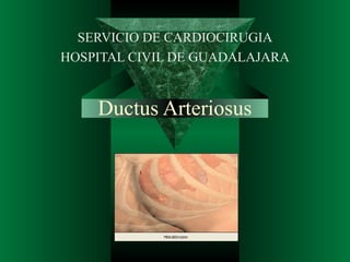 SERVICIO DE CARDIOCIRUGIA
HOSPITAL CIVIL DE GUADALAJARA


    Ductus Arteriosus
 
