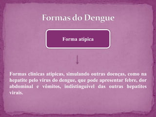 Forma indiferenciada
Assemelha-se a síndrome gripal, sintomatologia leve
 