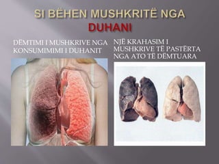 DËMTIMI I MUSHKRIVE NGA
KONSUMIMIMI I DUHANIT
NJË KRAHASIM I
MUSHKRIVE TË PASTËRTA
NGA ATO TË DËMTUARA
 