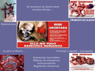 Histerotomía Dilatación con succión Curetaje o legrado - evacuación La peor el dinero … Sustancias inyectables Píldoras de emergencia Anticonceptivos Regulación menstrual El monstruo de aborto tiene muchas formas … 