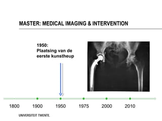 MASTER: MEDICAL IMAGING & INTERVENTION


      1950:
      Plaatsing van de
      eerste kunstheup
 